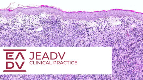 Membership Benefits | EADV