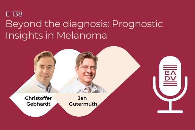 Beyond the diagnosis Prognostic Insights in Melanoma