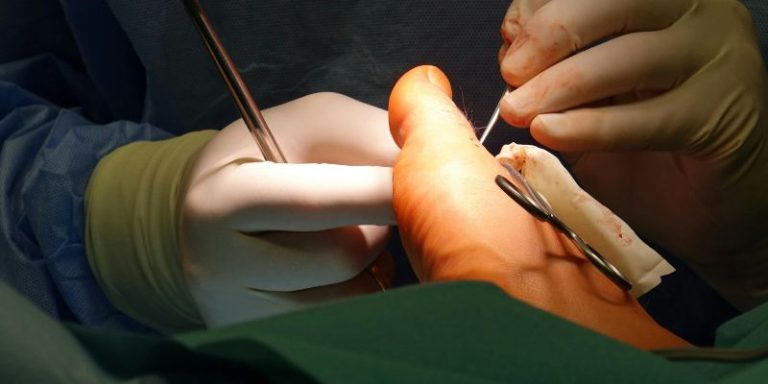 EADV course Advaced surgery on cadavers