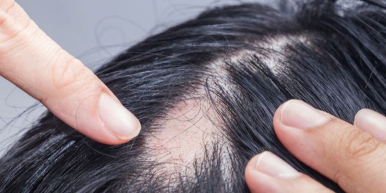 eadv course Updated approach to alopecia diagnosis