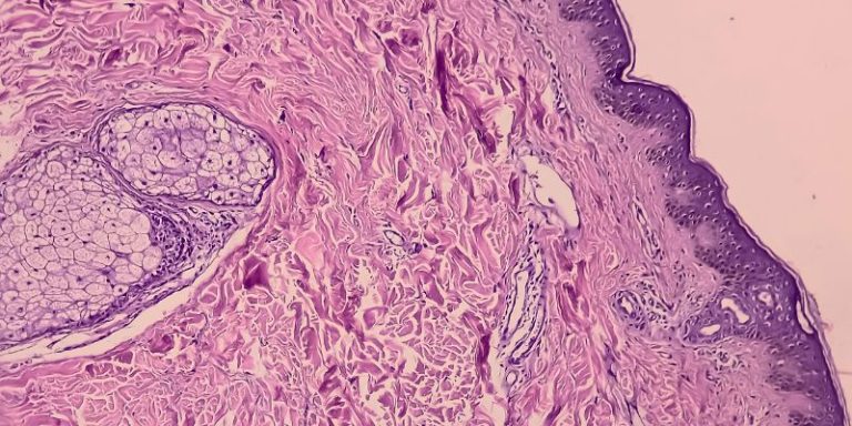 EADV Masterclass Athens 2026